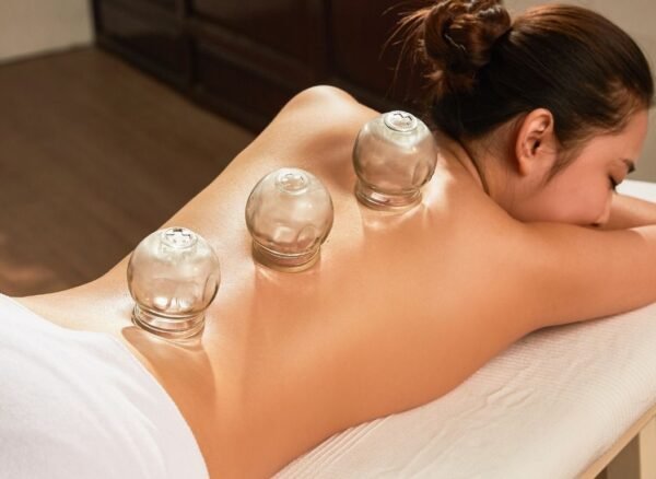 Cupping Therapy and Massage